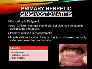 PRIMARY HERPETIC
GINGIVOSTOMATITIS
Caused by HSV type 1.
Age- Children younger than 6 yrs, but also may be seen in
adolescents and adults.
Primary infection is asymptomatic
Manifestations include blister on the lip so disease commonly
called recurrent herpes labialis.
Location-
hard palate
Attached gingiva
oral mucosa.
 