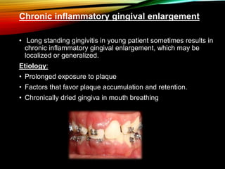 Chronic inflammatory gingival enlargement
• Long standing gingivitis in young patient sometimes results in
chronic inflammatory gingival enlargement, which may be
localized or generalized.
Etiology:
• Prolonged exposure to plaque
• Factors that favor plaque accumulation and retention.
• Chronically dried gingiva in mouth breathing
 