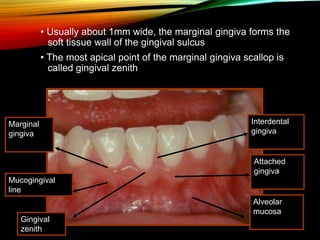 • Usually about 1mm wide, the marginal gingiva forms the
soft tissue wall of the gingival sulcus
• The most apical point of the marginal gingiva scallop is
called gingival zenith
Interdental
gingiva
Attached
gingiva
Alveolar
mucosa
Marginal
gingiva
Mucogingival
line
Gingival
zenith
 