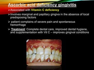 Ascorbic acid deficiency gingivitis
Associated with Vitamin C deficiency
Involves marginal and papillary gingiva in the absence of local
predisposing factors
 patient complains of severe pain and spontaneous
hemorrhage
 Treatment: Complete dental care, improved dental hygiene,
and supplementation with Vit C – improves gingival conditions
 