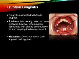 Eruption Gingivitis
Gingivitis associated with tooth
eruption.
Tooth eruption usually does not cause
gingivitis, however inflammation
associated with plaque accumulation
around erupting tooth may cause it.
Treatment: Complete dental care,
improve oral hygiene.
 