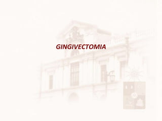 GINGIVECTOMIA 