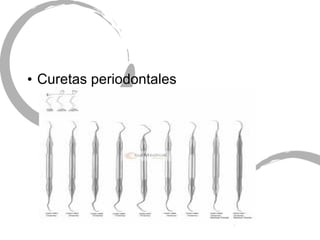 • Curetas periodontales
 