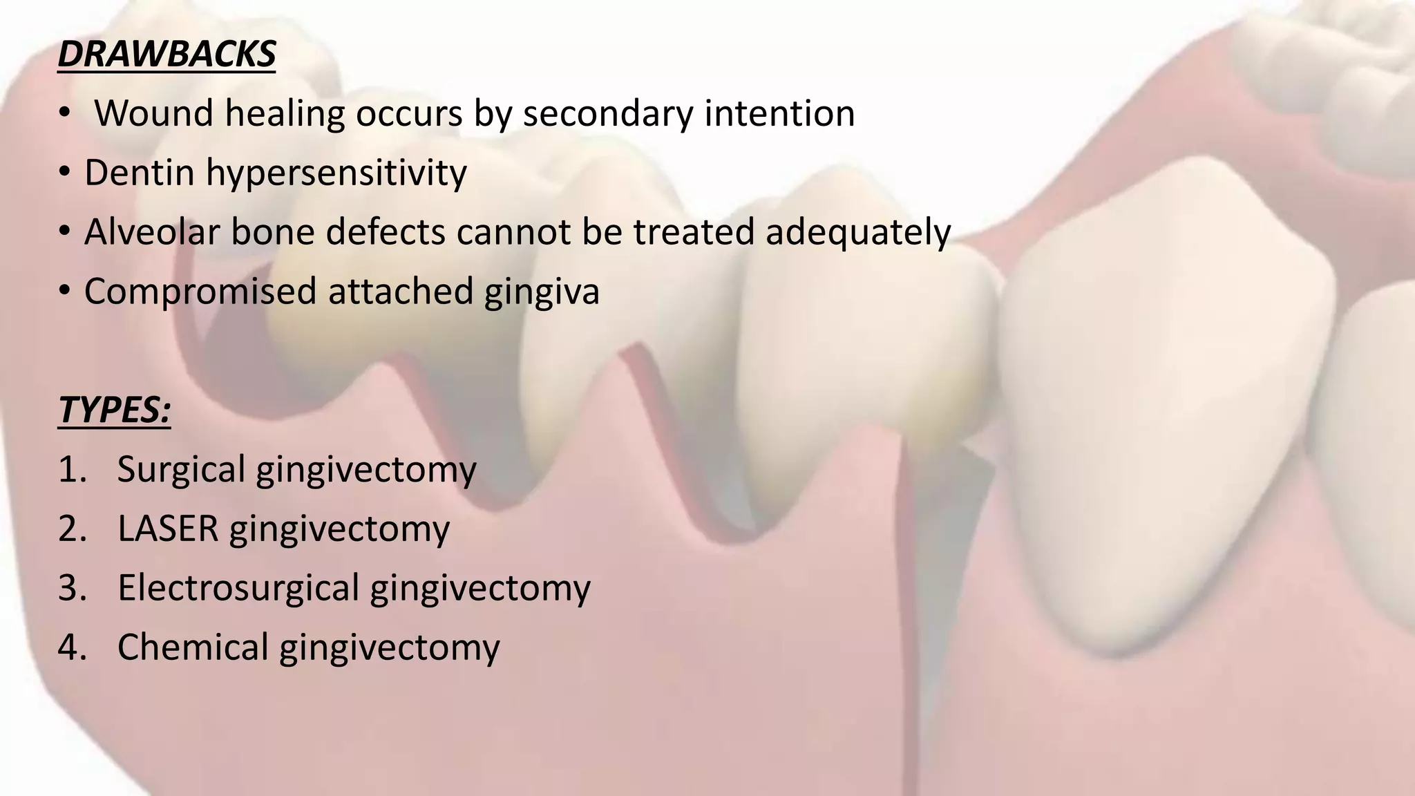Gingivectomy and Gingivoplasty