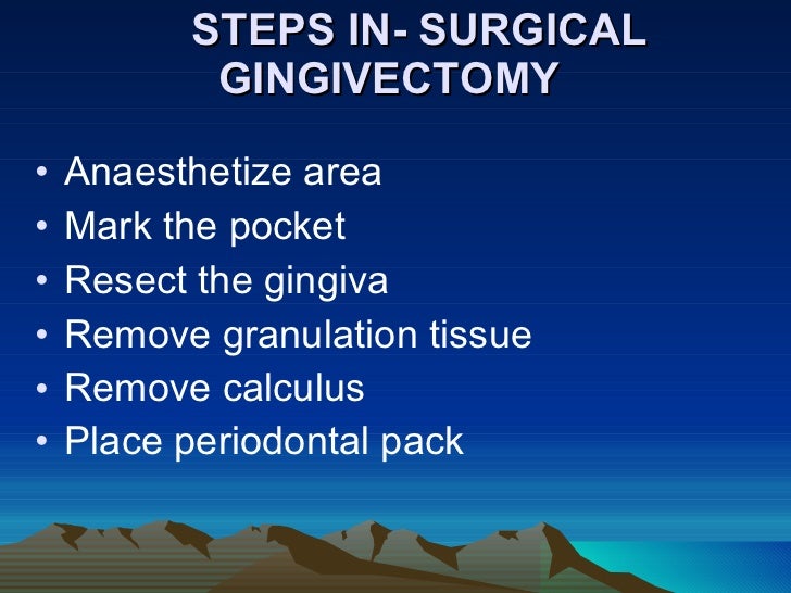 Gingivectomy