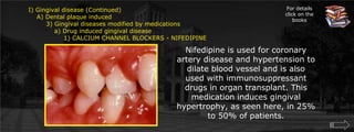 I) Gingival disease (Continued)    A) Dental plaque induced	3) Gingival diseases modified by medications	    a) Drug induced gingival disease		1) CALCIUM CHANNEL BLOCKERS - NIFEDIPINEFor details click on the books	Nifedipine is used for coronary artery disease and hypertension to dilate blood vessel and is also used with immunosuppressant drugs in organ transplant. This medication induces gingival hypertrophy, as seen here, in 25% to 50% of patients.