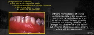 I) Gingival disease (Continued)    B) Non plaque induced gingival lesions  	5) Gingival manifestations of systemic conditions             b) Allergic reactions		1)  UNIDENTIFIED ALLERGENIntraoral manifestations of allergic reactions, specially in the gingiva, are characterized by marked erythema and superficial erosion. Patients generally complain of a burning sensation. The allergen was unidentified in this patient but cinnamon allergies can cause gingival lesions with this appearance.