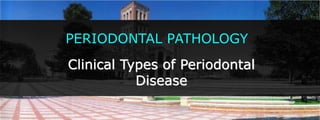 PERIODONTAL PATHOLOGY Clinical Types of Periodontal Disease 