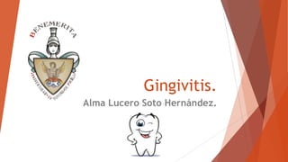 Gingivitis.
Alma Lucero Soto Hernández.

 