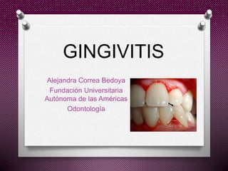 GINGIVITIS
Alejandra Correa Bedoya
Fundación Universitaria
Autónoma de las Américas
Odontología
 