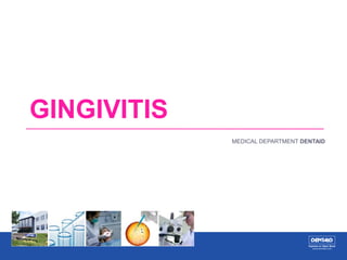 GINGIVITIS
MEDICAL DEPARTMENT DENTAID
 