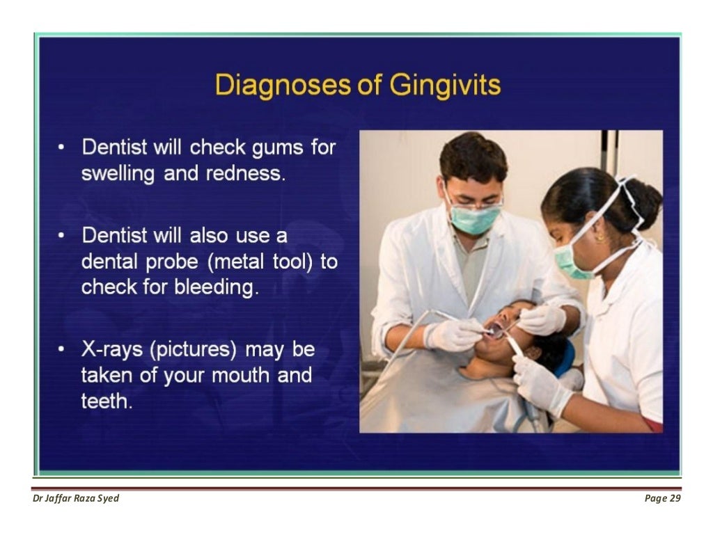 Gingivitis