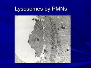Lysosomes by PMNsLysosomes by PMNs
 