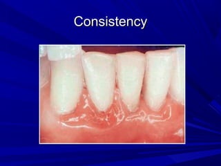 ConsistencyConsistency
 