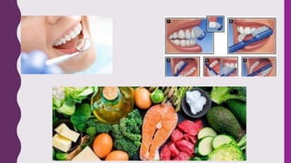 gingivitis.pptx_20231007_211343_0000.pptx