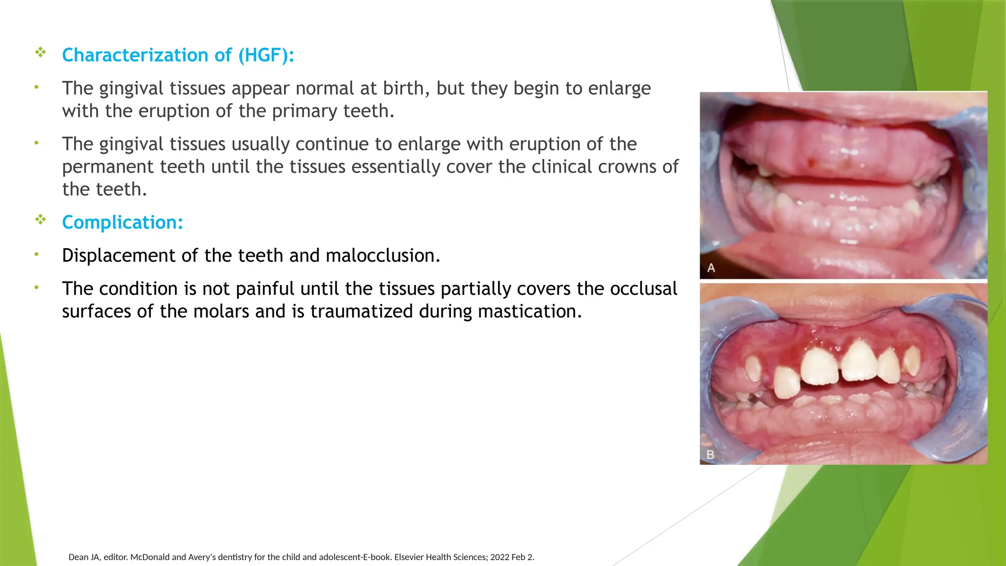 Gingivitis and Periodontal Disease last adjusments.pptx