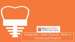 Gingivitis / Gum Disease: How to
Avoid and Treat It
 