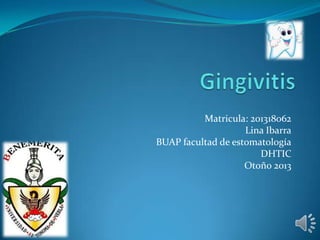 Matricula: 201318062
Lina Ibarra
BUAP facultad de estomatología
DHTIC
Otoño 2013

 