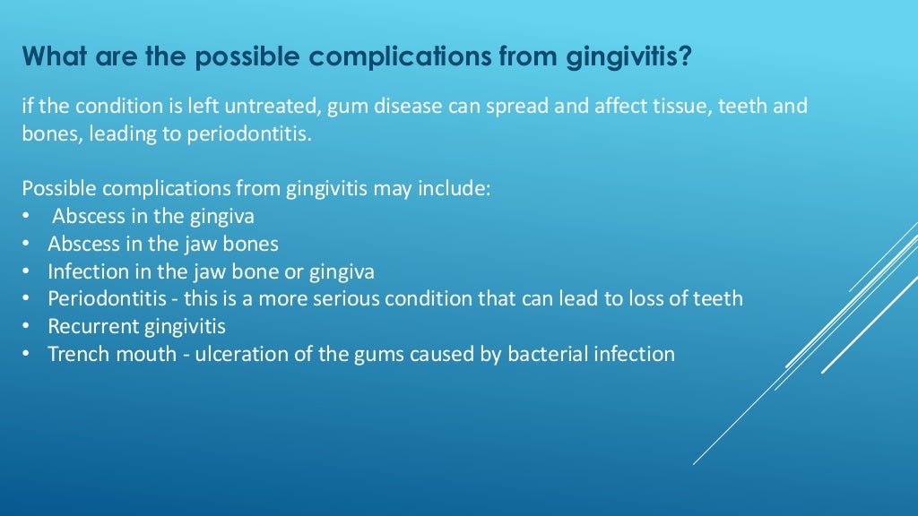 Gingivitis presentation