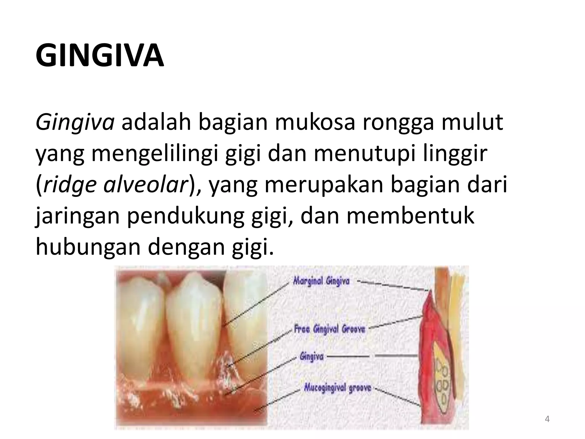 Bagian Ridge Gingivitis | PPTX