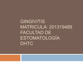 GINGIVITIS
MATRICULA: 201319489
FACULTAD DE
ESTOMATOLOGÍA
DHTC

 