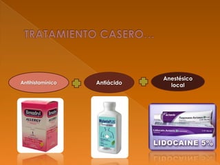 Antihistamínico
Anestésico
localAntiácido
 