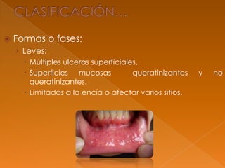 Formas o fases:
› Leves:
 Múltiples ulceras superficiales.
 Superficies mucosas queratinizantes y no
queratinizantes.
 Limitadas a la encía o afectar varios sitios.
 