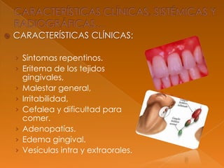  CARACTERÍSTICAS CLÍNICAS:
› Síntomas repentinos.
› Eritema de los tejidos
gingivales,
› Malestar general,
› Irritabilidad,
› Cefalea y dificultad para
comer.
› Adenopatías.
› Edema gingival.
› Vesículas intra y extraorales.
 
