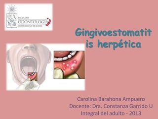 Gingivoestomatit
is herpética
Carolina Barahona Ampuero
Docente: Dra. Constanza Garrido U
Integral del adulto - 2013
 