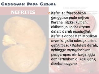 GANGGUAN PADA GINJAL

                  Nefritis: Disebabkan
                  gangguan pada nefron
                  karena infeksi kuman,
                  akibatnya kadar ureum
                  dalam darah meningkat.
                  Nefritis dapat menimbulkan
                  uremia, yaitu adanya urine
                  yang masuk kedalam darah,
                  sehingga menyebabkan
                  penyerapan air terganggu
                  dan tertimbun di kaki yang
                  disebut oegema.
 