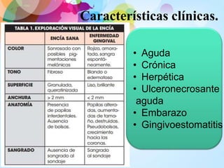 Características clínicas.
• Aguda
• Crónica
• Herpética
• Ulceronecrosante
aguda
• Embarazo
• Gingivoestomatitis
 