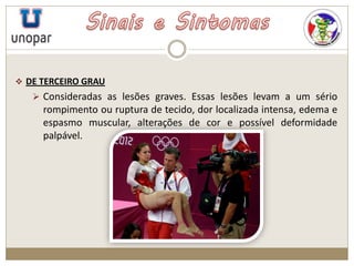  DE TERCEIRO GRAU
 Consideradas as lesões graves. Essas lesões levam a um sério
rompimento ou ruptura de tecido, dor localizada intensa, edema e
espasmo muscular, alterações de cor e possível deformidade
palpável.
 