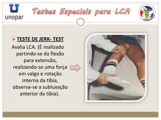  TESTE DE JERK- TEST
Avalia LCA. (É realizado
partindo-se da flexão
para extensão,
realizando-se uma força
em valgo e rotação
interna da tíbia,
observa-se a subluxação
anterior da tíbia).
 