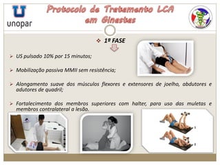  1ª FASE
 US pulsado 10% por 15 minutos;
 Mobilização passiva MMII sem resistência;
 Alongamento suave dos músculos flexores e extensores de joelho, abdutores e
adutores de quadril;
 Fortalecimento dos membros superiores com halter, para uso das muletas e
membros contralateral a lesão.
 