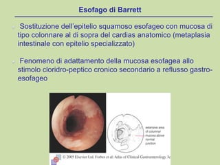 Esofago di Barrett
Sostituzione dell’epitelio squamoso esofageo con mucosa di
tipo colonnare al di sopra del cardias anatomico (metaplasia
intestinale con epitelio specializzato)
Fenomeno di adattamento della mucosa esofagea allo
stimolo cloridro-peptico cronico secondario a reflusso gastro-
esofageo
 