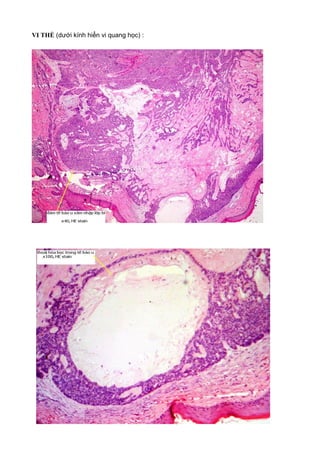 VI THỂ (dưới kính hiển vi quang học) :
 