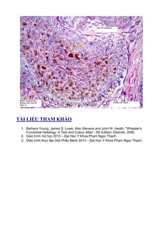 TÀI LIỆU THAM KHẢO
1. Barbara Young, James S. Lowe, Alan Stevens and John W. Heath. “Wheater's
Functional Histology: A Text and Colour Atlas”, 5th Edition, Elsevier, 2006.
2. Giáo trinh mô học 2013 – Đại Học Y Khoa Phạm Ngọc Thạch.
3. Giáo trinh thực tập Giải Phẫu Bệnh 2013 – Đại Học Y Khoa Phạm Ngọc Thạch.
 