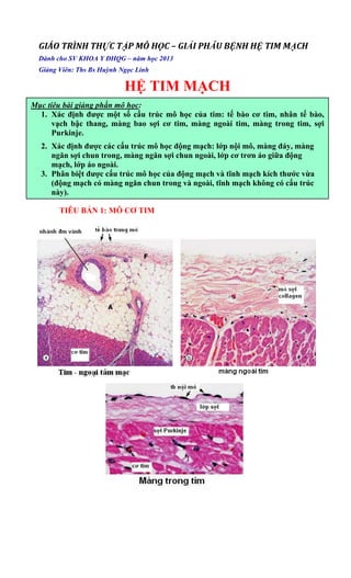GIÁO TRÌNH THỰC TẬP MÔ HỌC – GIẢI PHẪU BỆNH HỆ TIM MẠCH  
Dành cho SV KHOA Y ĐHQG – năm học 2013
Giảng Viên: Ths Bs Huỳnh Ngọc Linh
HỆ TIM MẠCH
TIÊU BẢN 1: MÔ CƠ TIM
Mục tiêu bài giảng phần mô học:
1. Xác định được một số cấu trúc mô học của tim: tế bào cơ tim, nhân tế bào,
vạch bậc thang, màng bao sợi cơ tim, màng ngoài tim, màng trong tim, sợi
Purkinje.
2. Xác định được các cấu trúc mô học động mạch: lớp nội mô, màng đáy, màng
ngăn sợi chun trong, màng ngăn sợi chun ngoài, lớp cơ trơn áo giữa động
mạch, lớp áo ngoài.
3. Phân biệt được cấu trúc mô học của động mạch và tĩnh mạch kích thước vừa
(động mạch có màng ngăn chun trong và ngoài, tĩnh mạch không có cấu trúc
này).
 