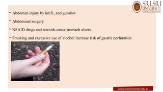 • Abdomen injury by knife, and gunshot
• Abdominal surgery
• NSAID drugs and steroids cause stomach ulcers
• Smoking and excessive use of alcohol increase risk of gastric perforation
www.srisriuniversity.edu.in
 
