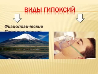 ВИДЫ ГИПОКСИЙ
Физиологические
Патологические
 