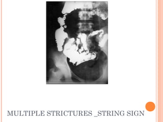 Gi radiology mbbs final | PPT