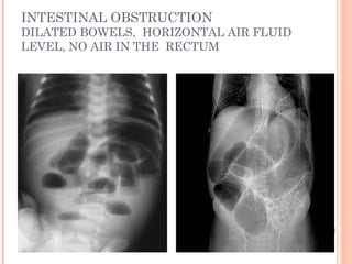 Gi radiology mbbs final | PPT