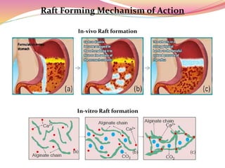 GI RAFT MEDICAL CME FOR CP-GP-CONSULTANT-DR.ARIF FARUQUI | PPTX