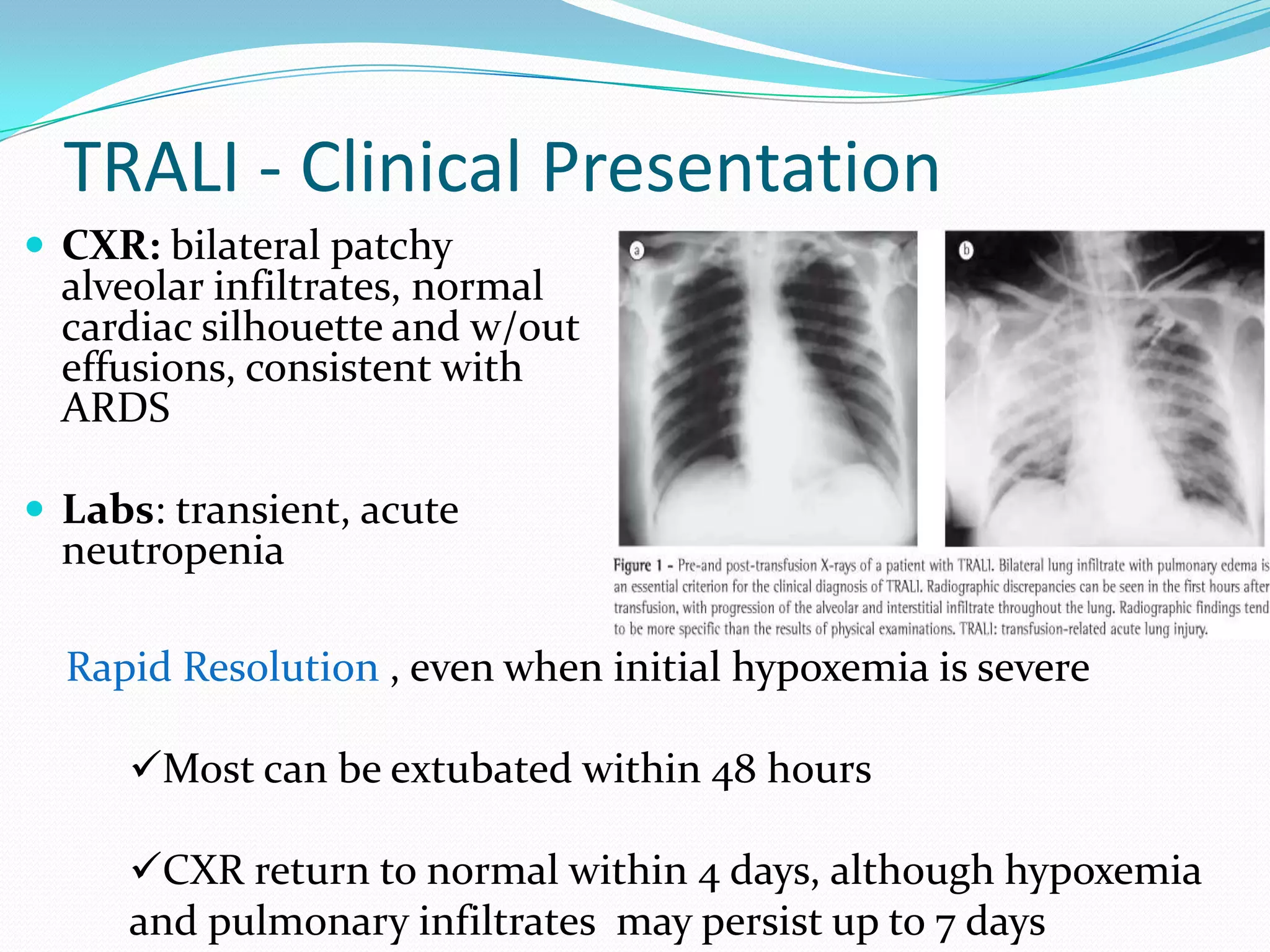 30 major blood group systems and over 200 minor group systemsLewisI P MNSs KellKiddDuffyThe cell surface is a jungle!