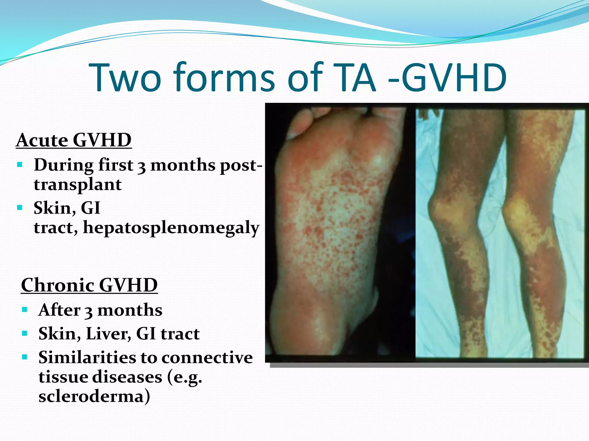 Hemolytic transfusion reactions Transfusion of RBCs to a patient with a preexisting antibody may cause a hemolytic reaction. Acute hemolytic transfusion (within 24h):  fever, chills, chest/back/abdominal pain, pain at the infusion site, dyspnea, hypotension, Hb-nuria, renal failure and DICAlloantibodies: IgM (anti-A and -B) or IgG 