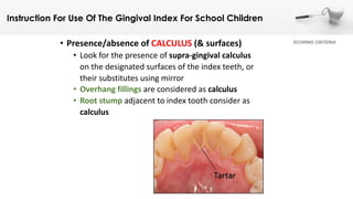 Gingival Index For Schoolchildren | PDF