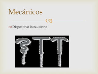 
Dispositivo intrauterino
Mecánicos