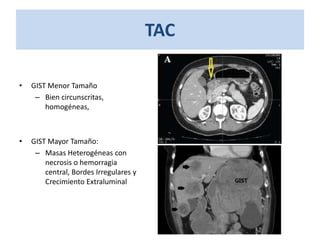 TAC
• GIST Menor Tamaño
– Bien circunscritas,
homogéneas,
• GIST Mayor Tamaño:
– Masas Heterogéneas con
necrosis o hemorragia
central, Bordes Irregulares y
Crecimiento Extraluminal
 