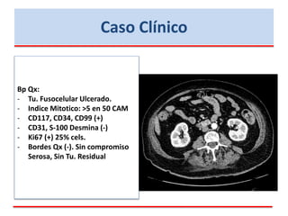 Caso Clínico
Bp Qx:
- Tu. Fusocelular Ulcerado.
- Indice Mitotico: >5 en 50 CAM
- CD117, CD34, CD99 (+)
- CD31, S-100 Desmina (-)
- Ki67 (+) 25% cels.
- Bordes Qx (-). Sin compromiso
Serosa, Sin Tu. Residual
 