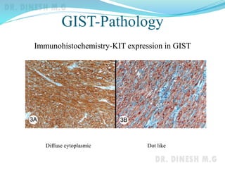 GIST | PPTX